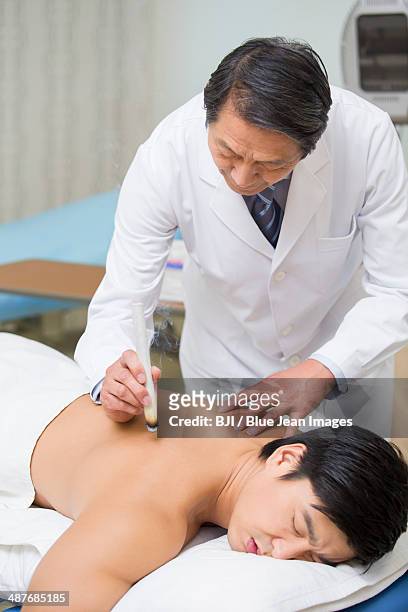 senior doctor giving moxibustion - acupuncture elderly stock pictures, royalty-free photos & images