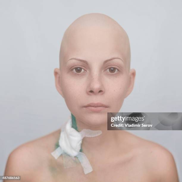 bald caucasian cancer patient with bandage on neck - 剃った頭 ストックフォトと画像