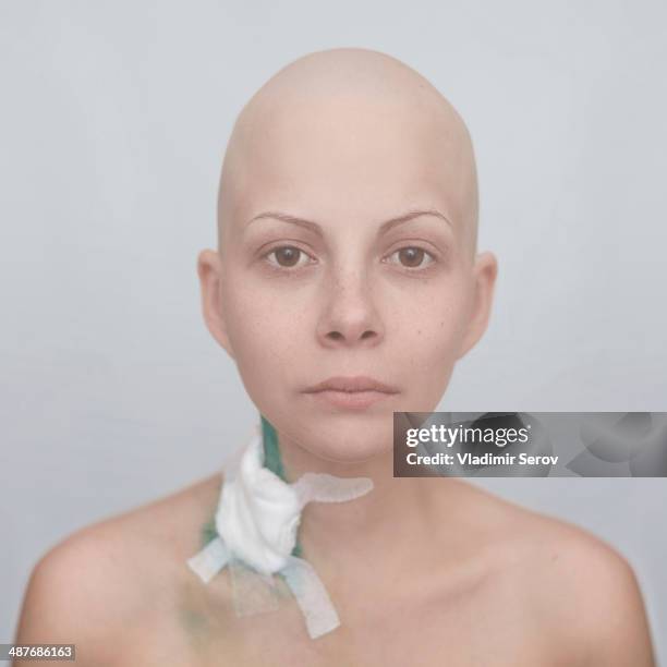 bald caucasian cancer patient with bandage on neck - shaved head stockfoto's en -beelden