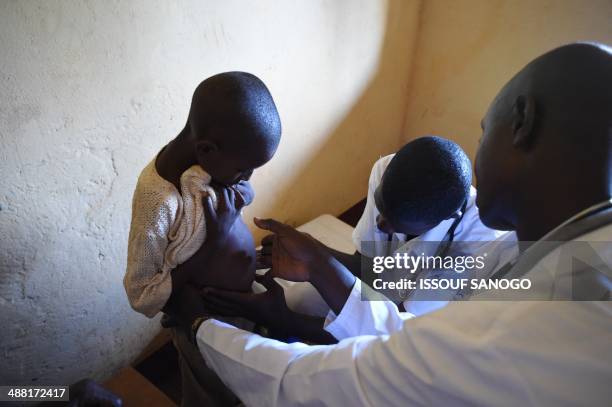 Child with a bloated stomach showing the symptoms of the Kwashiorkor disease is looked at by doctors at a centre for displaced muslims fleeing the...