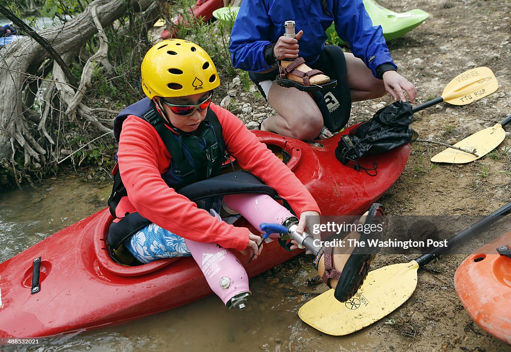 Stacey Phipps, below the knee amputee, with her new prosthetic feet.