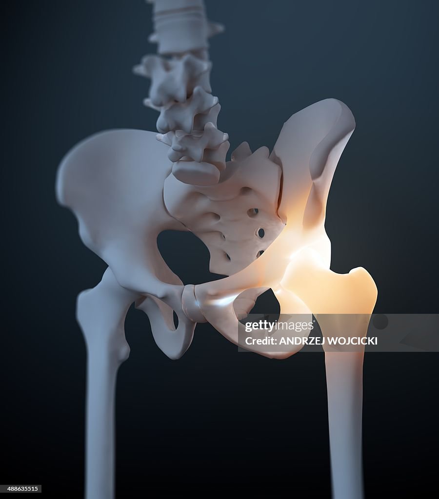 Hip and pelvis pain , artwork