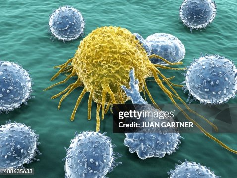 Lymphocytes and cancer cell Lymphocytes and cancer cell