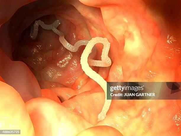 tapeworm, artwork - taenia saginata stock illustrations