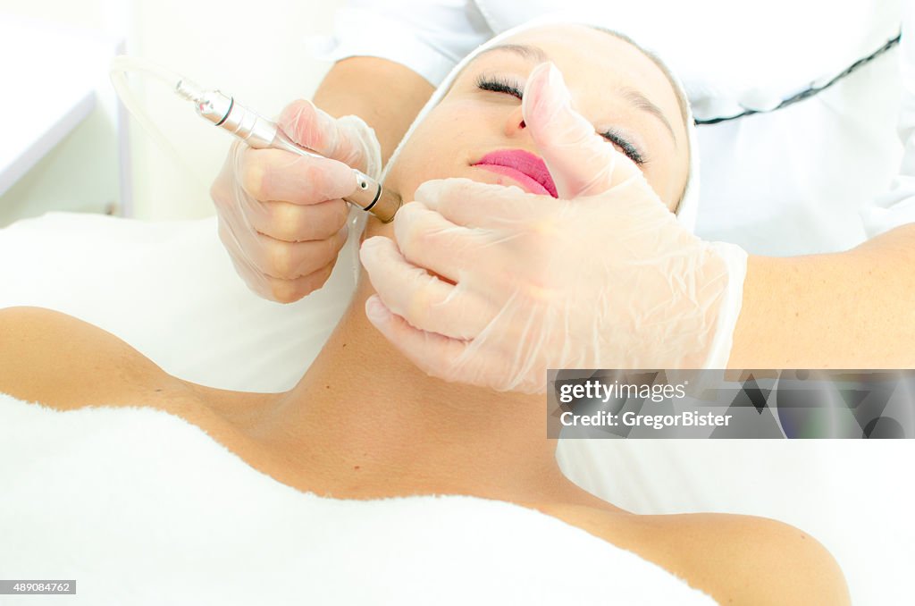 Microdermabrasion treatment