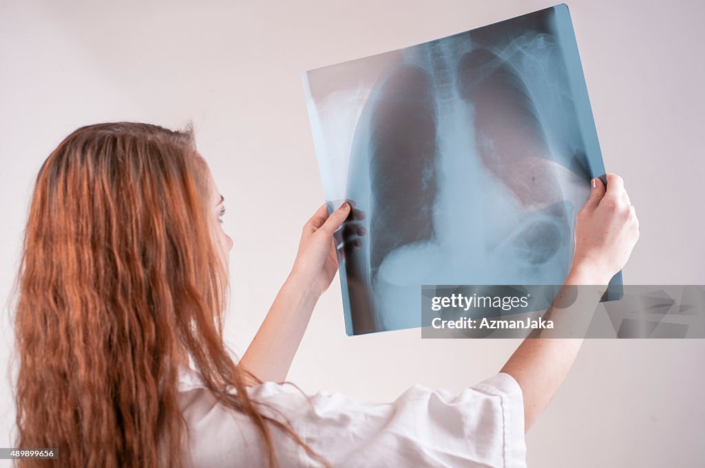 Medical student looking at lung x-ray