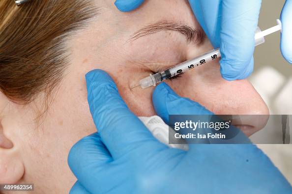 Botox injection Botox injection