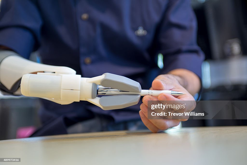 3D-Printed Prosthetic Arm Developed In Japan