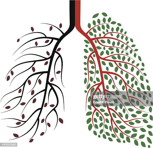 健康な部位と疾患部位人の肺のコンセプト - 生理学点のイラスト素材／クリップアート素材／マンガ素材／アイコン素材
