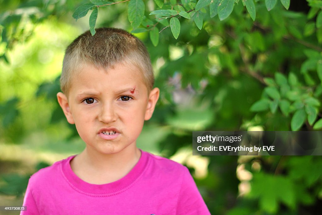 Little boy with a gash on his eyebrow