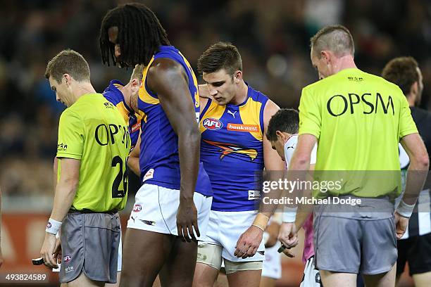 Elliott Yeo of the Eagles looks to the ground after losing two teeth during the round 10 AFL match between the Collingwood Magpies and West Coast...