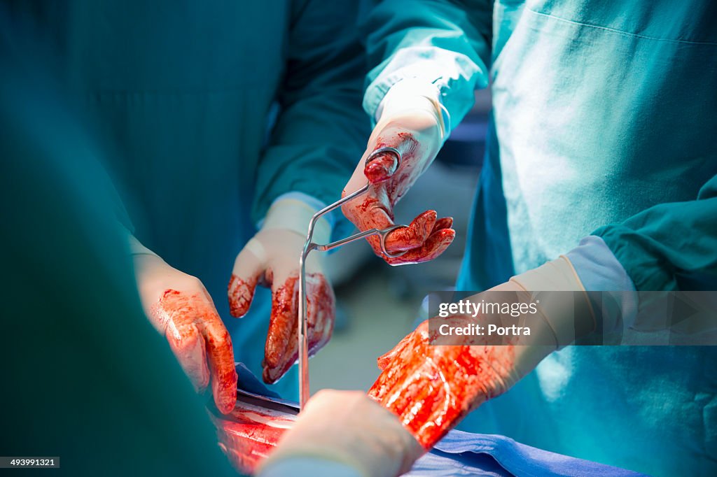 Bloody surgical hands of doctors