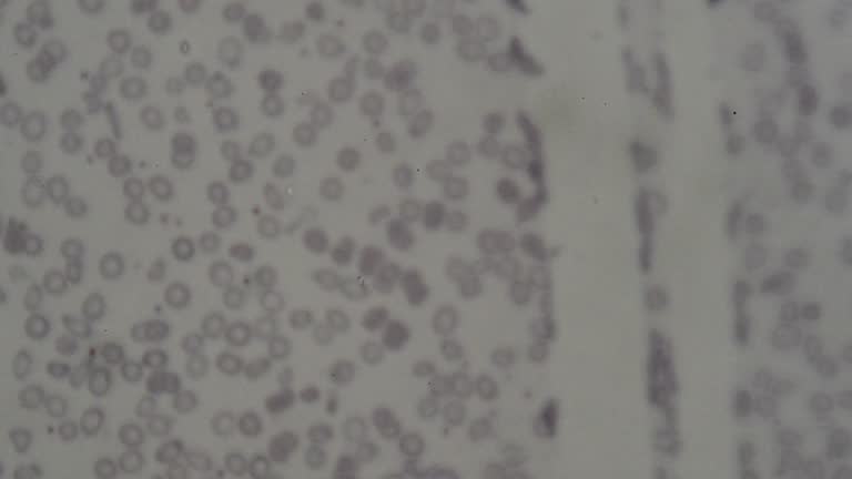 Red Blood Cell Under Microscope Videos and HD Footage - Getty Images