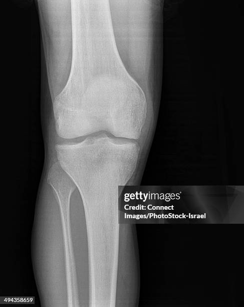 Front Rise Knee 124 Right Knee Anatomy Stock Photos, High-Res Pictures, and Images ...