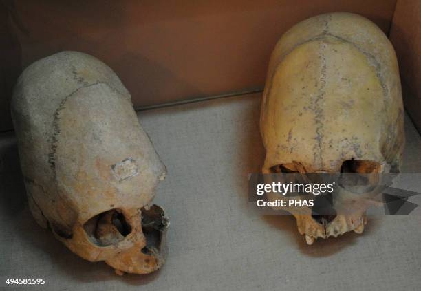 Sarmatians. Two deformed human skulls. Probably dated in the 3rd century BC. Kerch Historical and Archaeological Museum. Autonomous Republic of...