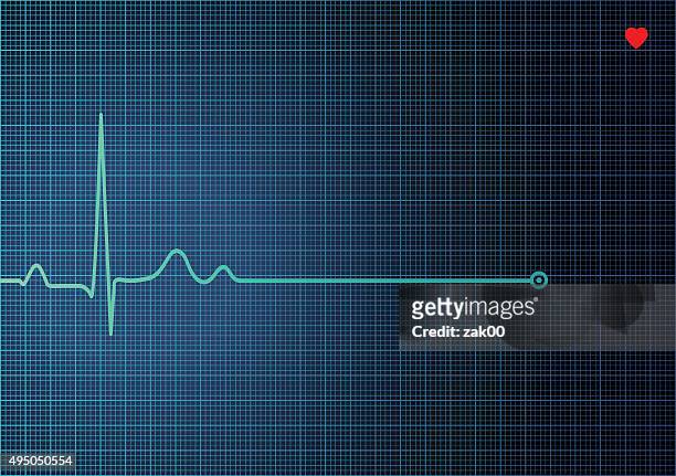electrocardiogram ekg - taking pulse stock illustrations