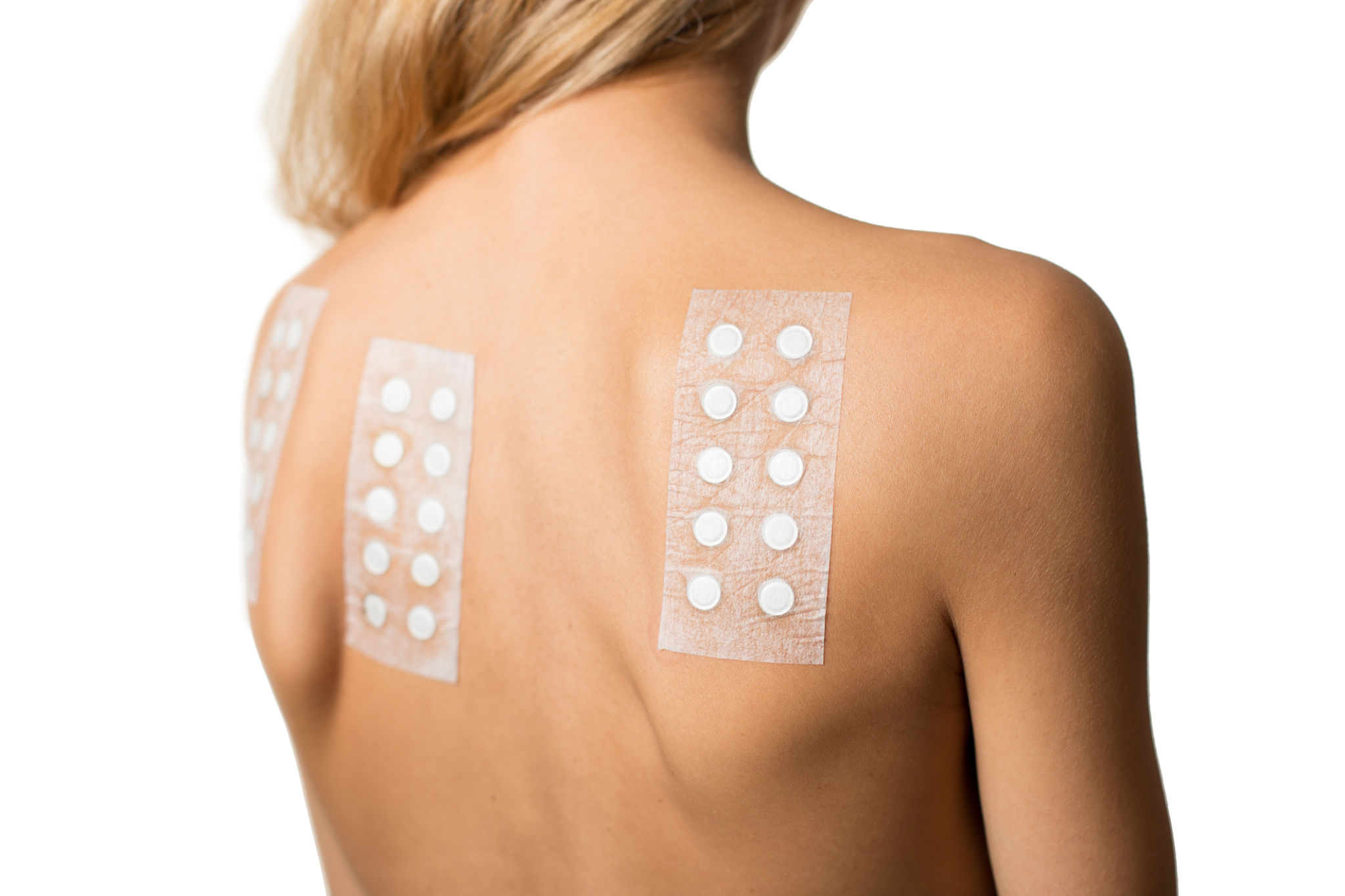 patch test