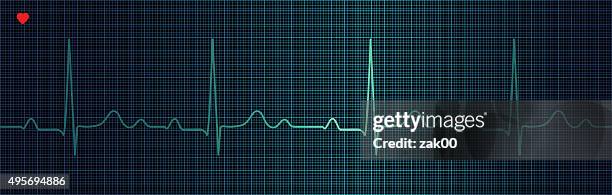 cardiogram - taking pulse stock illustrations