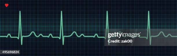 stockillustraties, clipart, cartoons en iconen met ekg trace - naar de hartslag luisteren