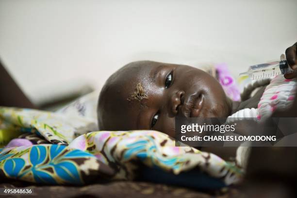 One-year-old Nyalou Thong, survivor of a cargo plane crash, rests on a bed at a hospital in Juba on November 5, 2015. A Russian-built Antonov An-12...