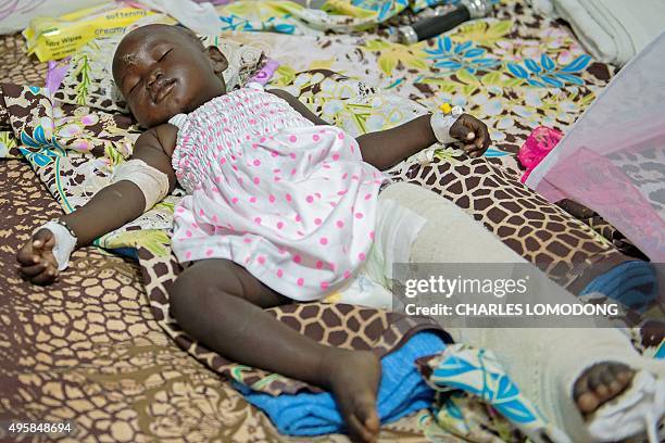 One-year-old Nyalou Thong, survivor of a cargo plane crash, rests on a bed at a hospital in Juba on November 5, 2015. A Russian-built Antonov An-12...