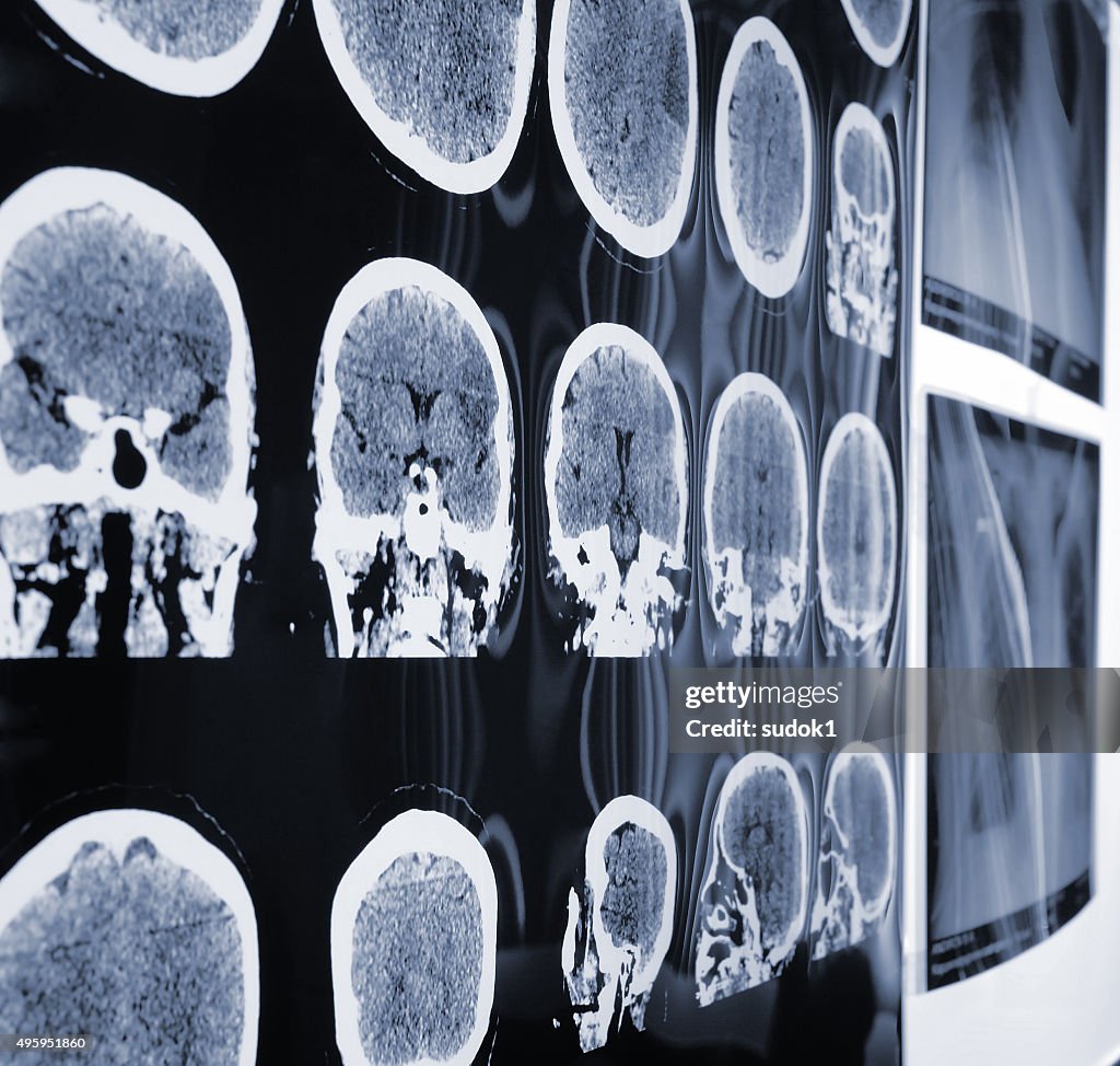 ユニークな眺め、MRI 、の際、患者の X 線ディスカッションです。