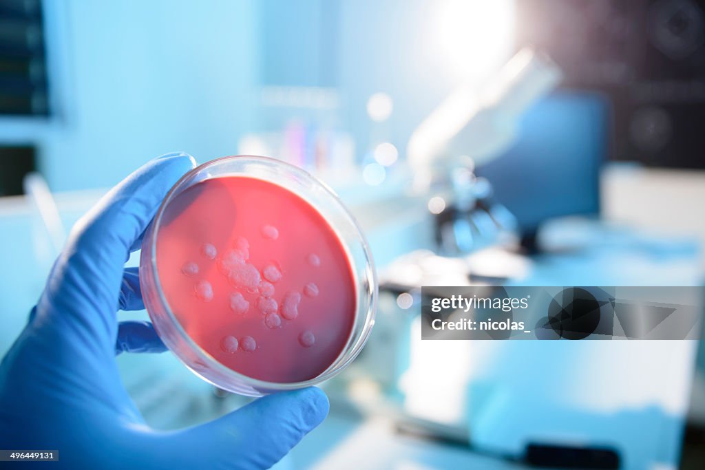 Mikrobiologischer Kultur