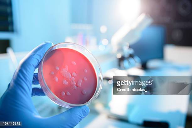 microbiological culture - infectious disease stockfoto's en -beelden