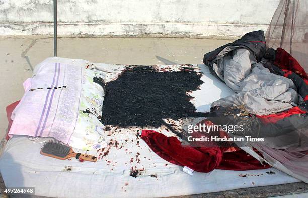 Bed-sheet that got burnt in the acid attack on a Russian woman at a house in Nand Nagar locality on November 14, 2015 in Varanasi, India. The...