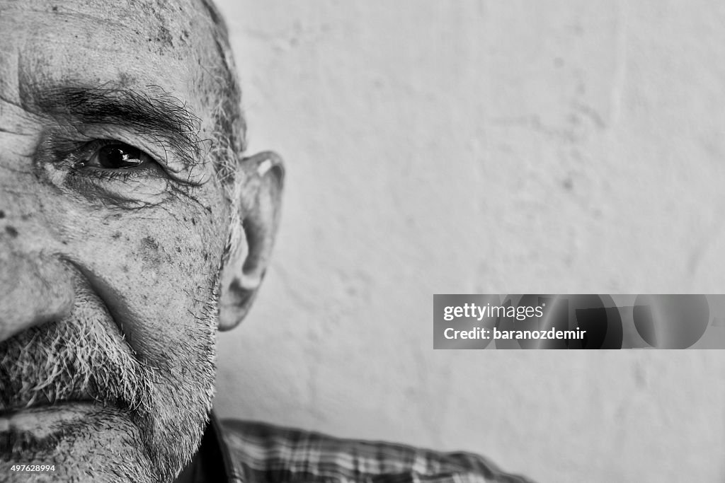 Portrait of an Alzheimer's Patient, Close-up