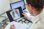 doctor looking at x-ray of lungs and writing diagnosis