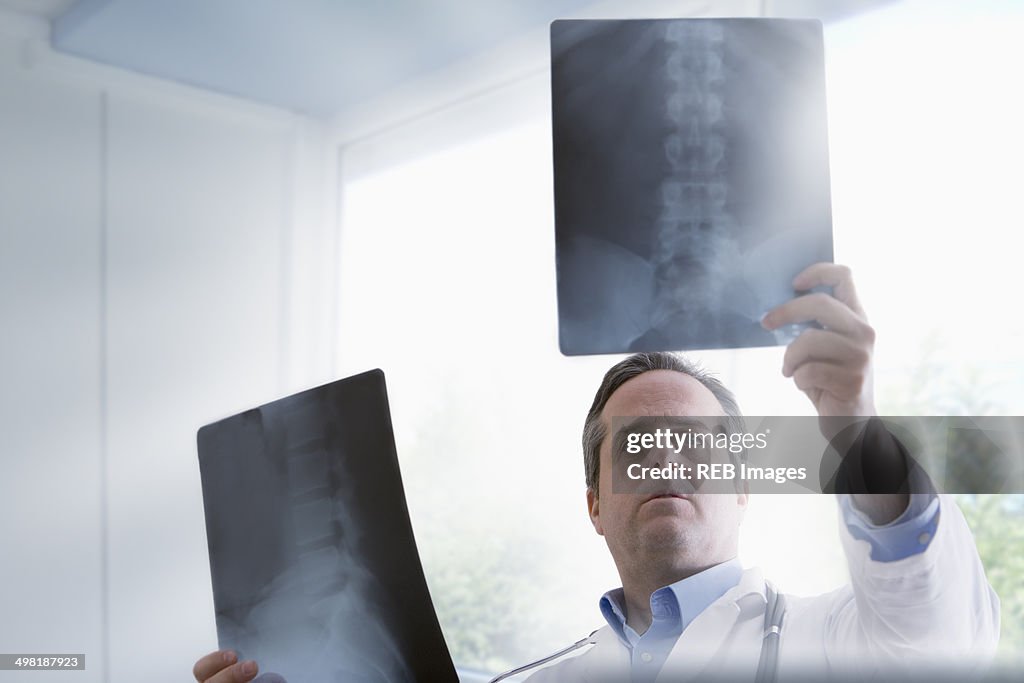 Doctor studying x-rays