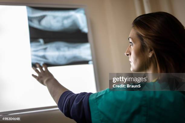 young female radiologist looking at an x-ray image. - diagnostic medical tool stock pictures, royalty-free photos & images