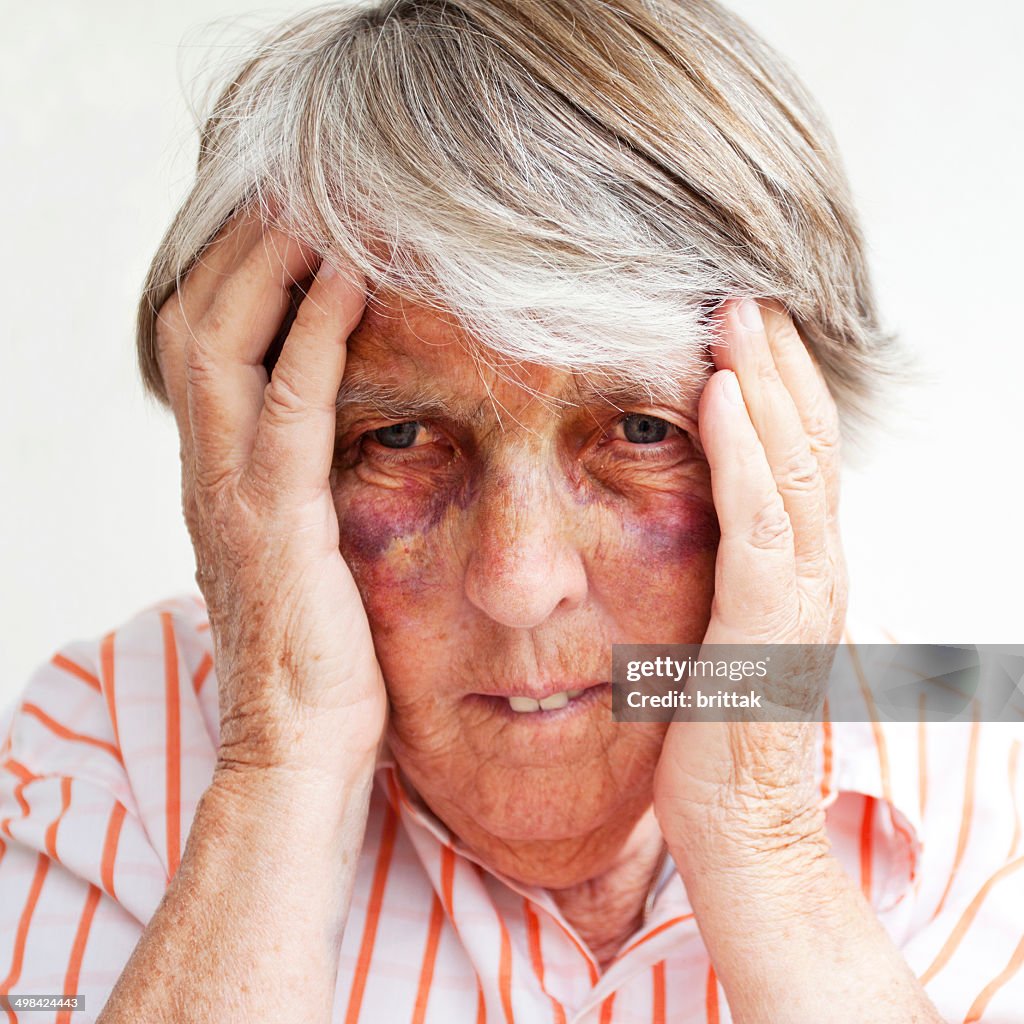 Close up of battered senior woman with bruises