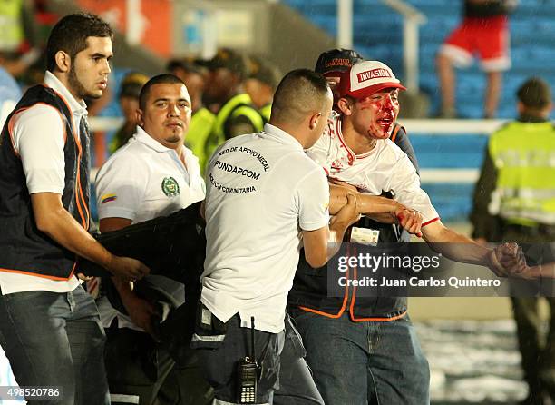 An injured fan of America de Cali is carried after a fight during a match between America de Cali and Bucaramanga as part of fourth round of...