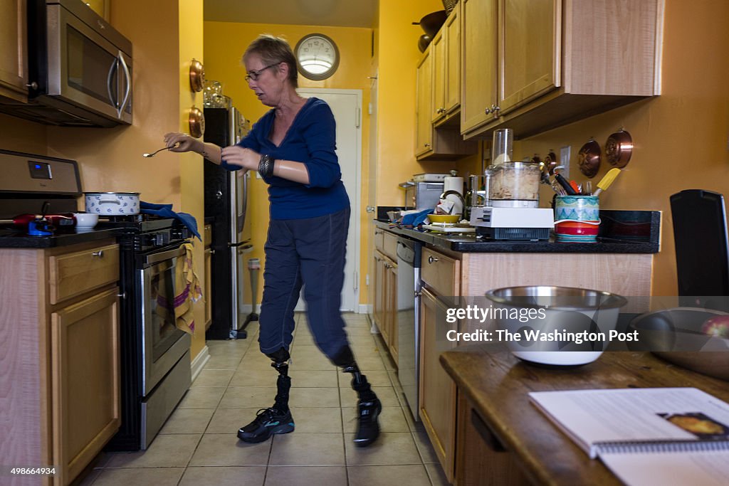 Cheryl Douglass, a quadruple amputee, cooks Thanksgiving dinner