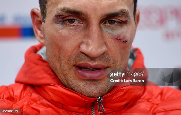 Wladimir Klitschko looks on at the press conference after he losed his World Heavyweight title to Tyson Fury after the IBF IBO WBA WBO Heavyweight...