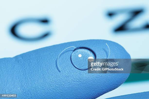 intraocular lens on gloved finger. intraocular lens is an artificial lens surgically implanted in the human eye following extraction of the natural crystalline lens clouded by cataract. - lens eye stock-fotos und bilder