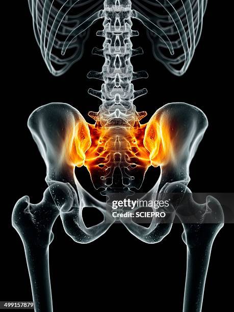 Si Joint Athrogram Si Joint Photos and Premium High Res Pictures - Getty Images