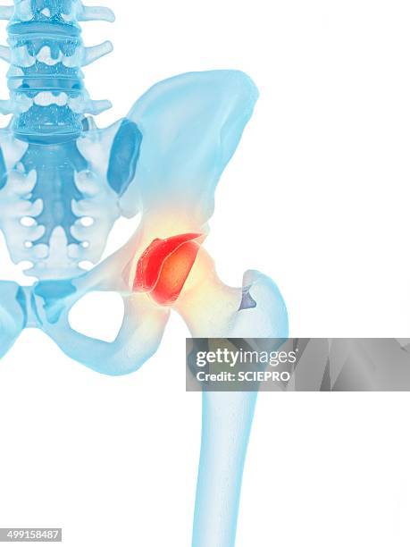 human hip joint, artwork - hip bone stock-grafiken, -clipart, -cartoons und -symbole