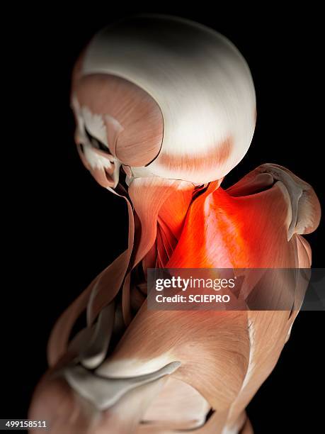 human neck muscles, artwork - neck muscle pain illustration stock illustrations