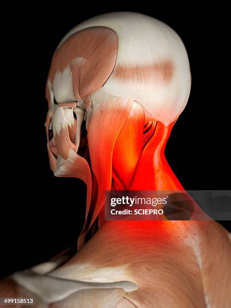 human neck muscles, artwork - neck muscle pain illustration stock illustrations