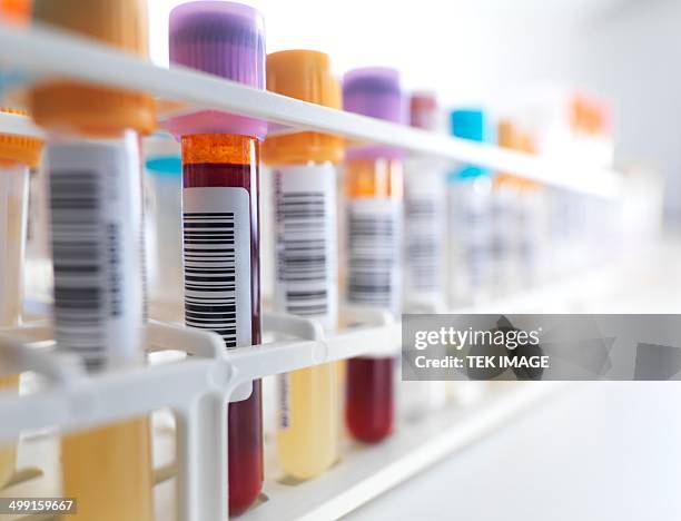 blood samples in rack - reageerbuisrek stockfoto's en -beelden