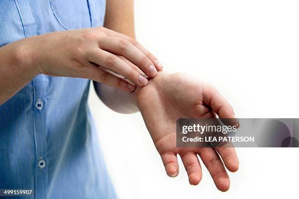 teenage girl scratching wrist - hautkrankheiten stock-fotos und bilder