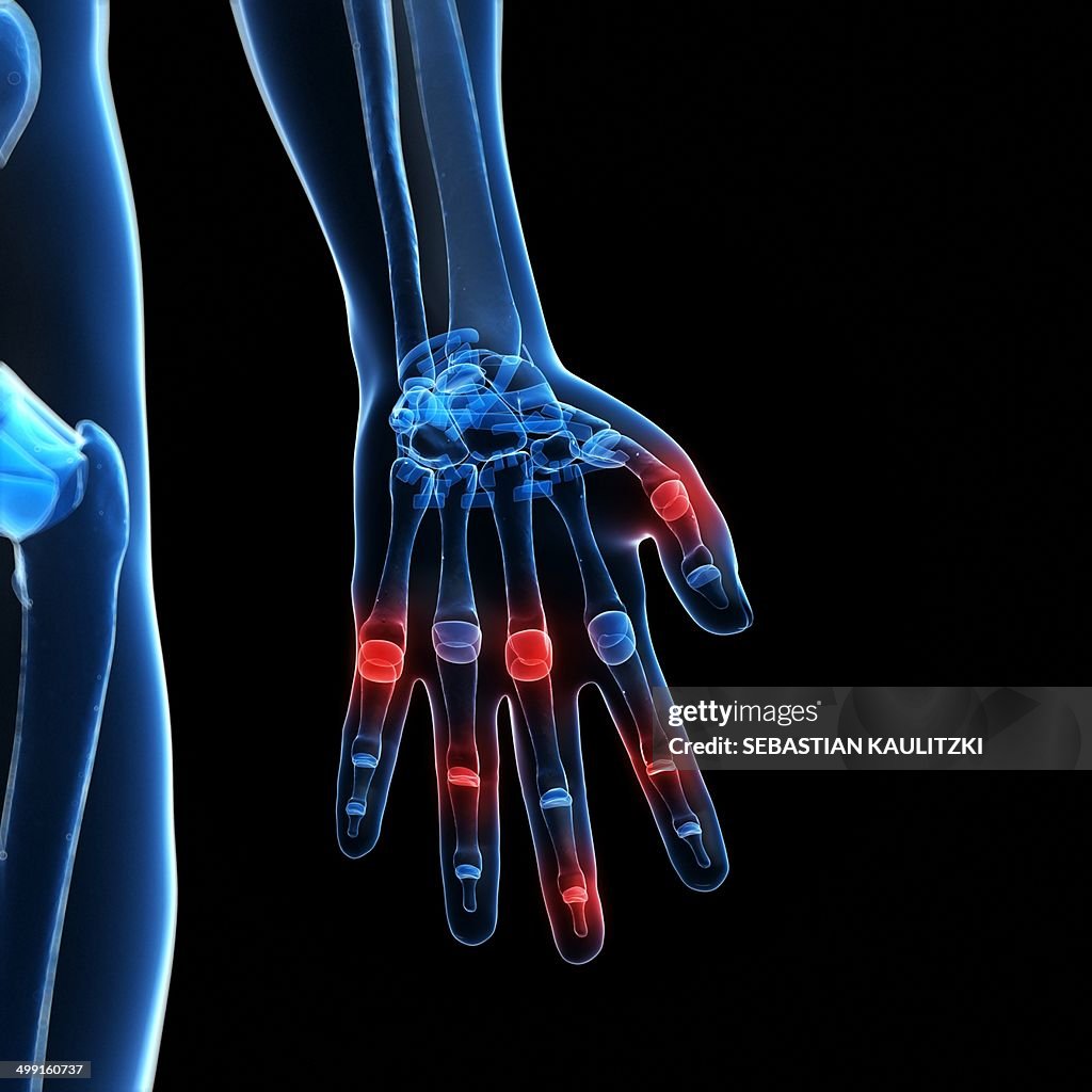 Human finger joints, artwork