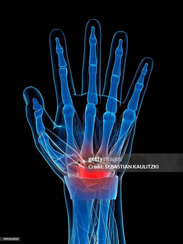 Human wrist, artwork