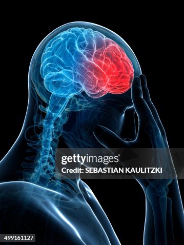 Headache, artwork Headache, artwork