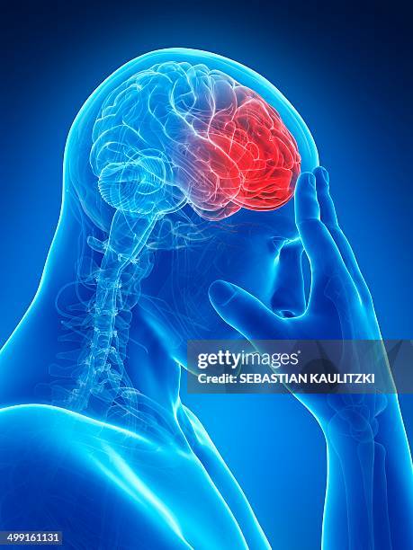 headache, artwork - headache stock illustrations