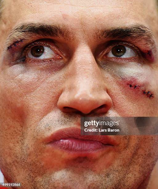 Wladimir Klitschko looks on at the press conference after he losed his World Heavyweight title to Tyson Fury after the IBF IBO WBA WBO Heavyweight...