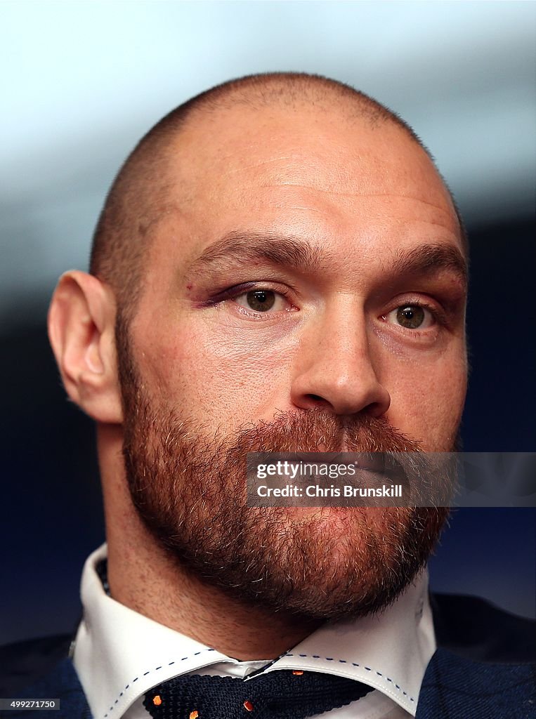 Tyson Fury Press Conference